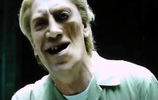 (Nearly) every Bond villain needs a deformity of some sort.