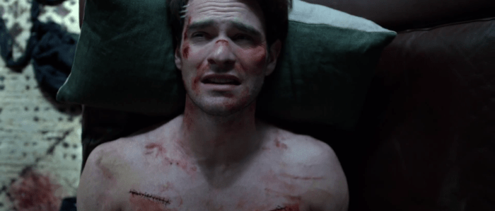 Matt Murdock's Scars on Netflix
